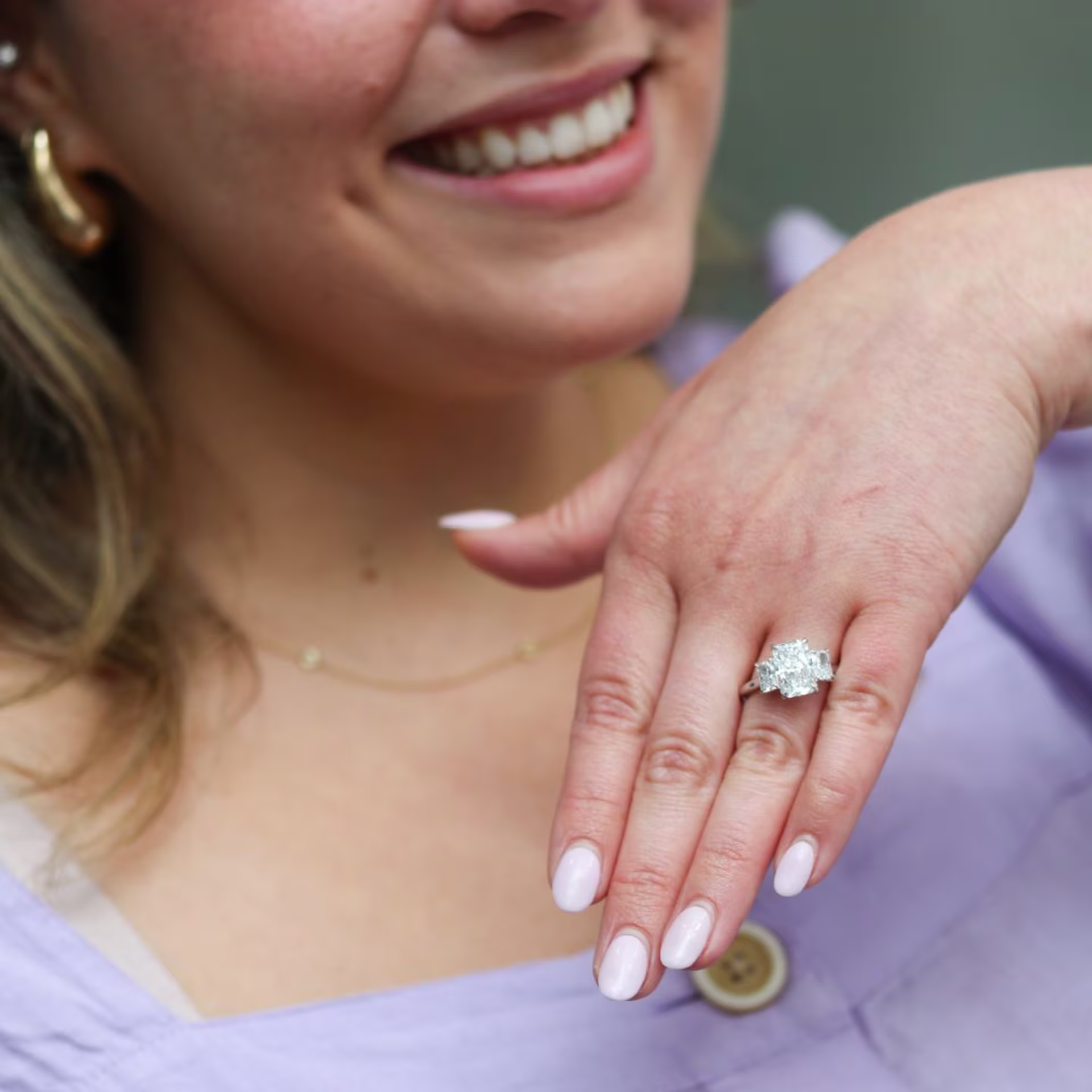 Close-up of gold ring on skin showing hypoallergenic metal options